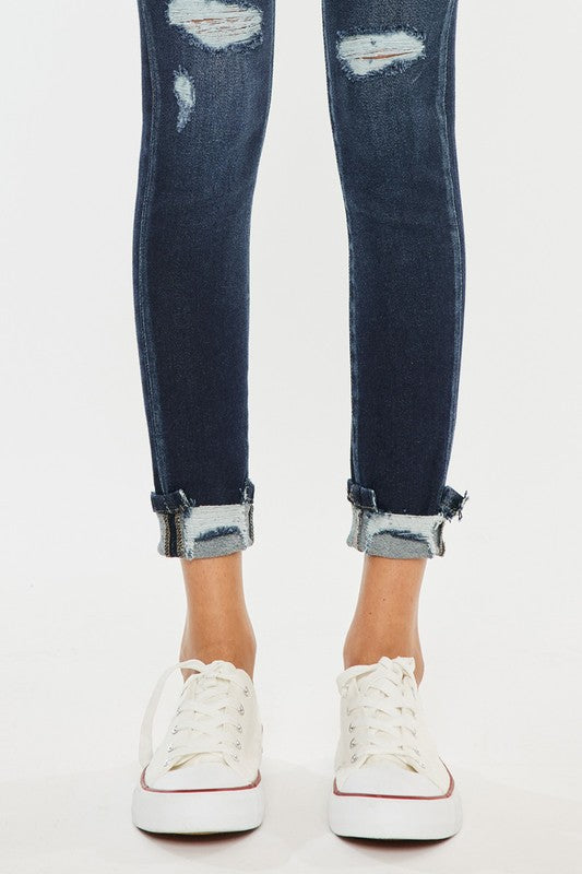 Kailey High Rise Button Down Skinny Jeans